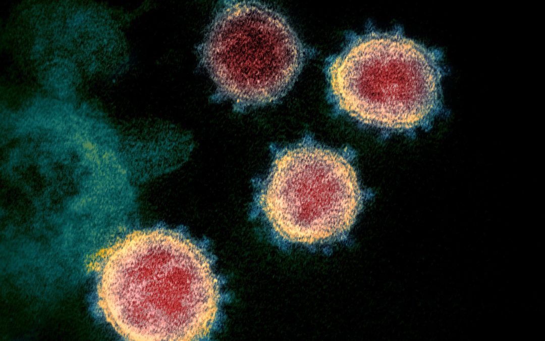 Gedanken zum Coronavirus SARS-CoV-2 und die Erkrankung Covid-19